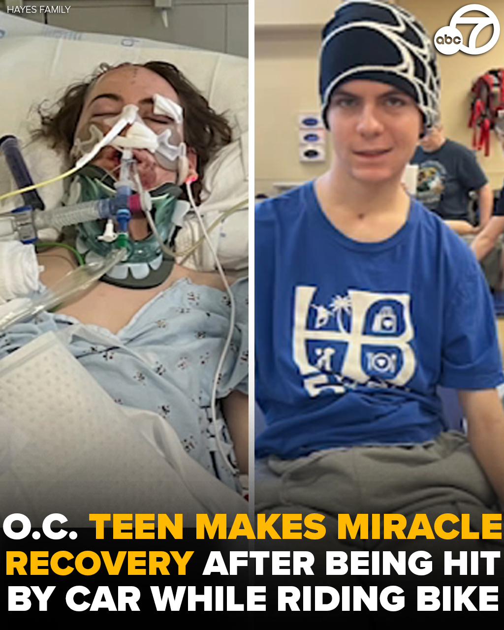 Huntington Beach teenager makes miracle recovery after being hit by car