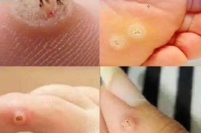 Be very careful if it comes out in your mouth, you are…