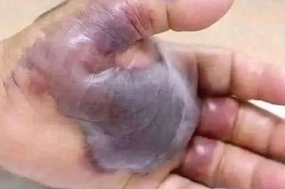 ATTENTION to these first signs of!