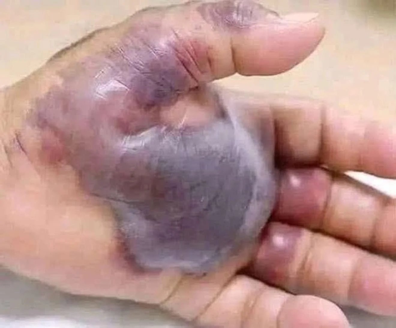 ATTENTION to these first signs of!