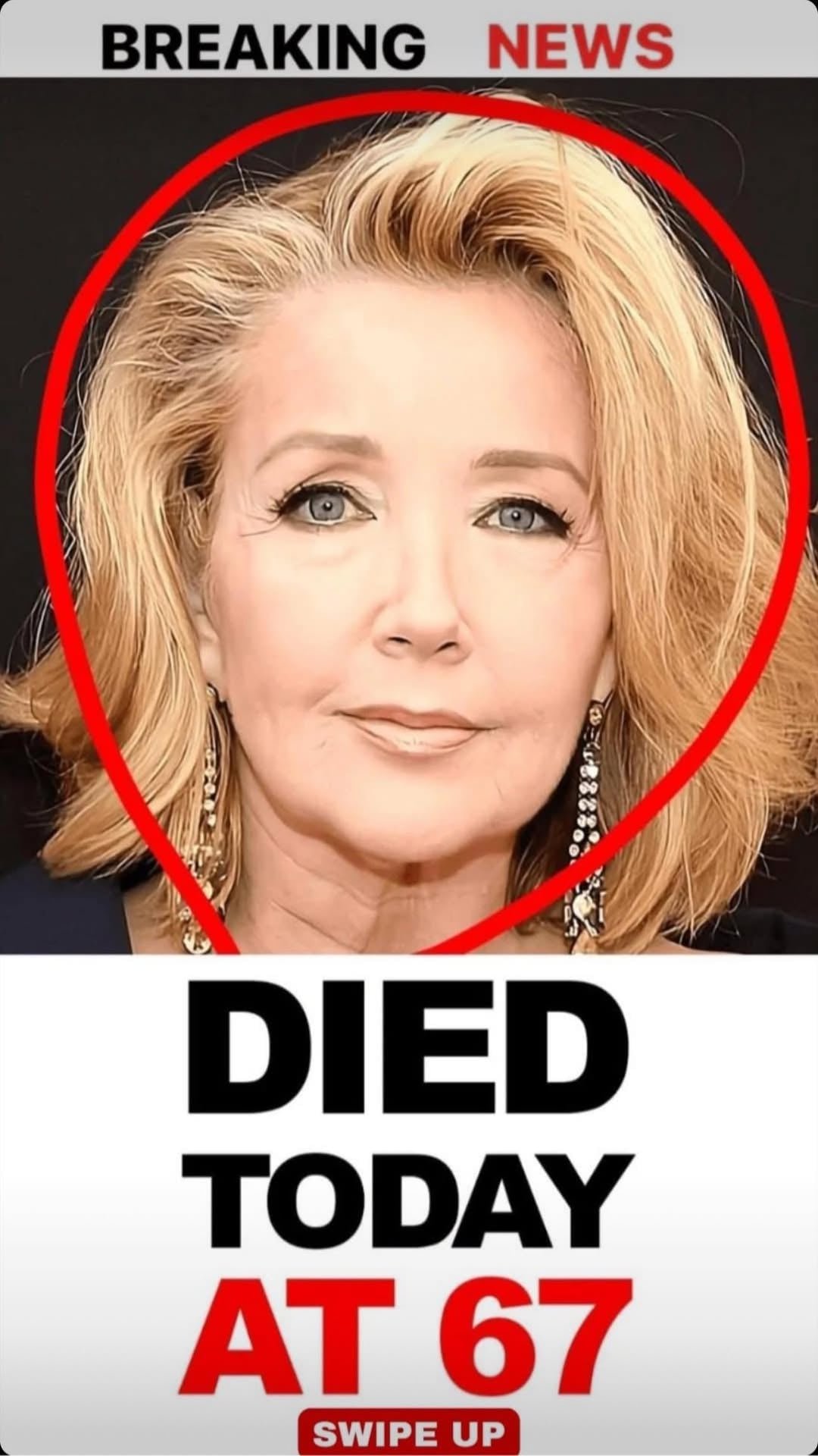 Famous actress opens up about her plastic surgery