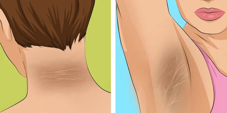 9 Warning Signs of Diabetes You Might Be Overlooking