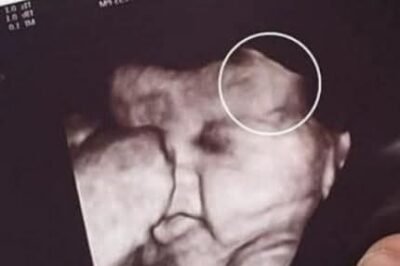 Mother is scared to see her daughter’s ultrasound; image showed the