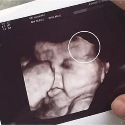 Mother is scared to see her daughter’s ultrasound; image showed the