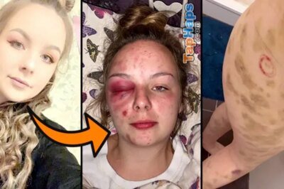 Severely Beaten Girl Reports Gang-Rape, Police Criminally Charge Her