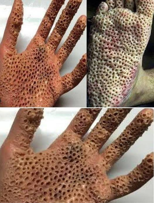 Have you noticed these red spots on your skin? Find out why they exist.