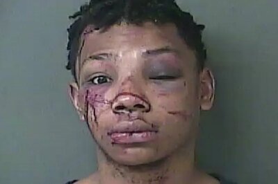 Armed Would-be Robber Gets Face Rearranged By Apartment Residents