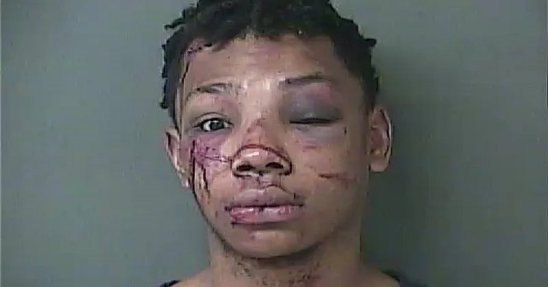 Armed Would-be Robber Gets Face Rearranged By Apartment Residents