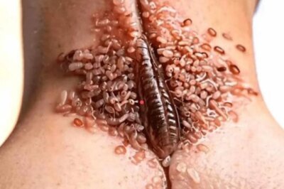 Changes in the Face That Indicate Serious Health Issuess