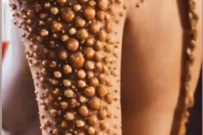 10 Signs Showing Something Is Wrong in Your Body