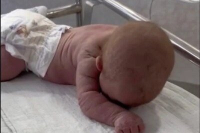 Baby born with an DIU peg… See more