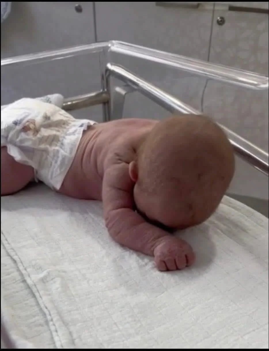 Baby born with an DIU peg… See more
