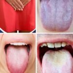 What your tongue can tell you about your health: 5 symptoms