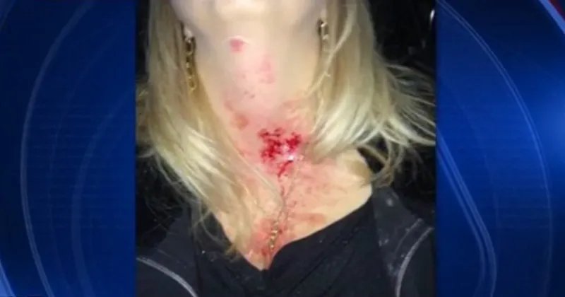 Woman Warns Other Drivers After Feeling Like She Was Shot