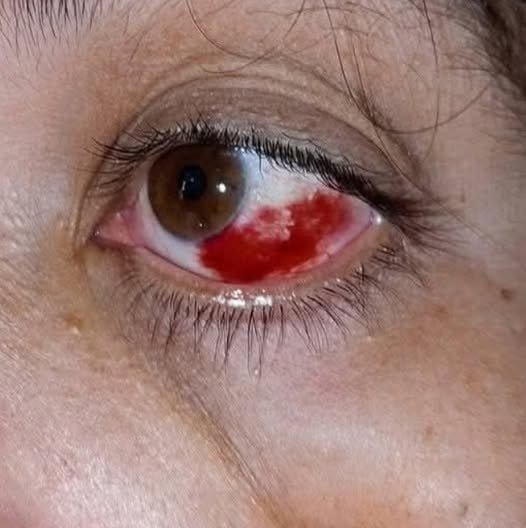 These are the consequences