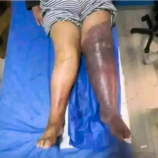 These are the consequences of sleeping with a…